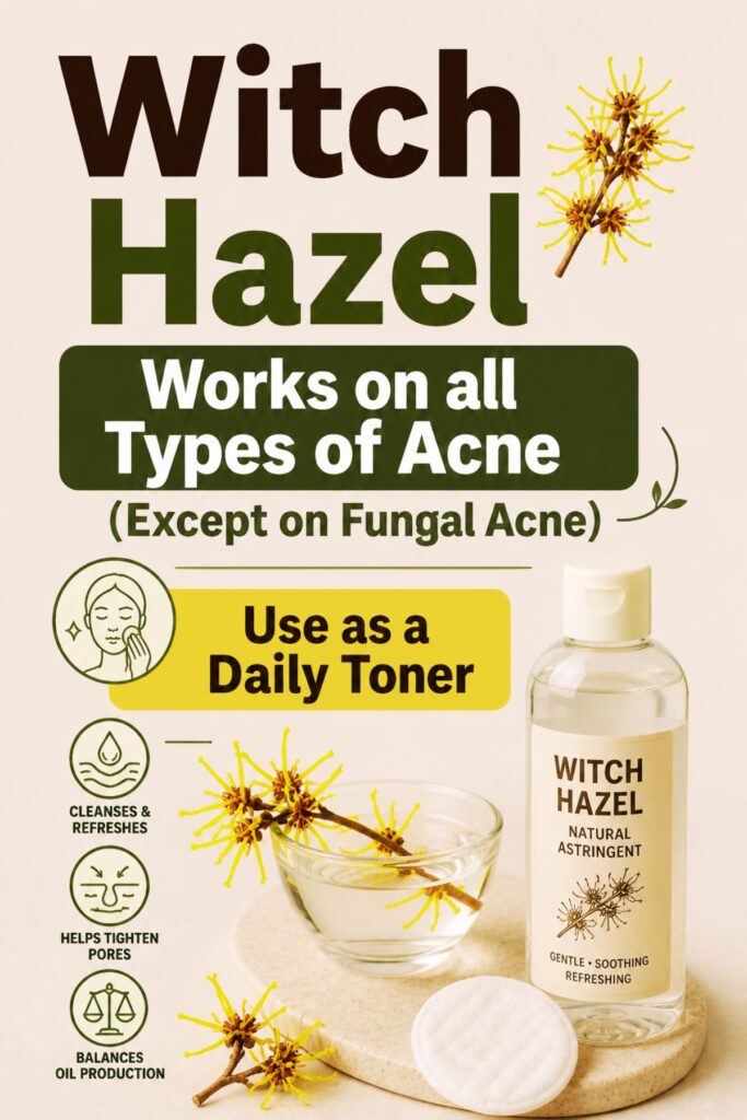 how to clear up acne with witchhazel