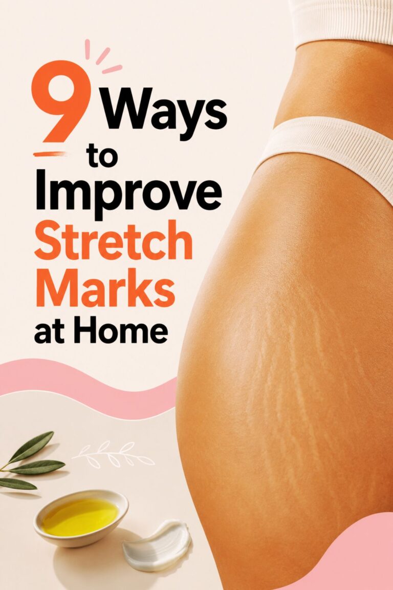 stretch mark remedies